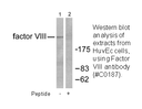 Product image for Factor VIII Antibody