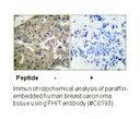 Product image for FHIT Antibody