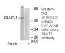 Product image for GLUT1 Antibody