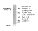 Product image for Guanylate Cyclase &beta; Antibody