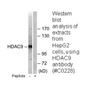 Product image for HDAC9 Antibody