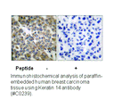 Product image for Keratin 14 Antibody