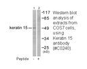 Product image for Keratin 15 Antibody