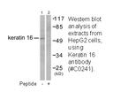 Product image for Keratin 16 Antibody