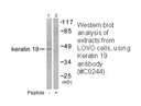 Product image for Keratin 19 Antibody