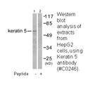 Product image for Keratin 5 Antibody