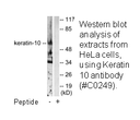 Product image for Keratin 10 Antibody