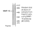 Product image for MMP-16 Antibody