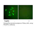 Product image for PDGFR &alpha; Antibody