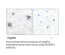 Product image for PDGFR &alpha; Antibody