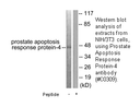 Product image for Prostate A8520 Response protein-4 Antibody