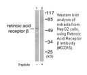 Product image for Retinoic Acid Receptor &beta; Antibody