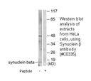 Product image for Synuclein &beta; Antibody