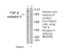 Product image for TGF &beta; Receptor II Antibody