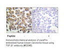 Product image for TGF &beta;1 Antibody