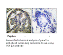 Product image for TGF &beta;2 Antibody