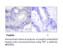 Product image for TGF &alpha; Antibody