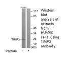 Product image for TIMP3 Antibody