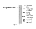 Product image for Transglutaminase 2 Antibody