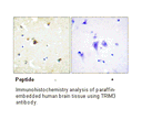 Product image for TRIM3 Antibody