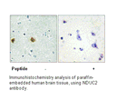 Product image for NDUC2 Antibody