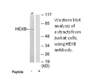 Product image for HEXB Antibody