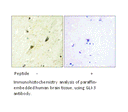 Product image for GLI-3 Antibody