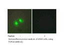 Product image for TOP2A Antibody