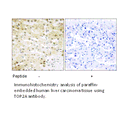 Product image for TOP2A Antibody