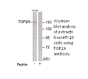 Product image for TOP2A Antibody