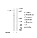 Product image for FER Antibody