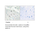 Product image for JAK1 Antibody