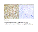 Product image for CALR Antibody