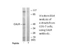 Product image for CALR Antibody