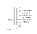 Product image for TF2E2 Antibody