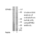 Product image for EPHB2 Antibody