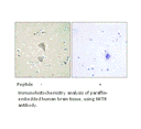 Product image for NKTR Antibody