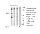 Product image for GRK5 Antibody