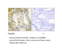 Product image for Catenin-&beta;1 Antibody