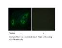 Product image for ATP7B Antibody