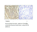 Product image for ATP7B Antibody