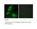 Product image for LTBR Antibody