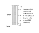 Product image for LTBR Antibody