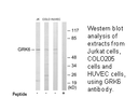 Product image for GRK6 Antibody