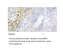 Product image for CKI-&alpha; Antibody