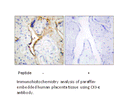 Product image for CKI-&epsilon; Antibody