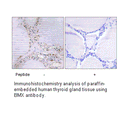 Product image for BMX Antibody