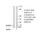 Product image for NCBP2 Antibody