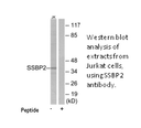 Product image for SSBP2 Antibody