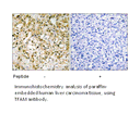 Product image for TFAM Antibody